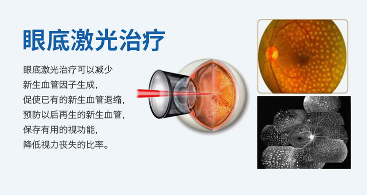 眼底设备