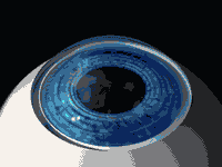 1522218102114855.gif 准分子近视激光手术.gif